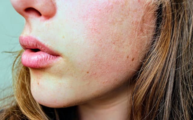 Keeping Your Skin Hydrated is the Key to Beauty